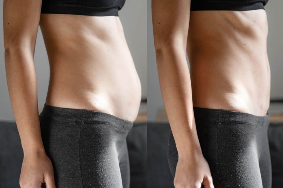 Post-Pregnancy: What Happens to Your Abdominal Muscles After Birth Bury St Edmunds