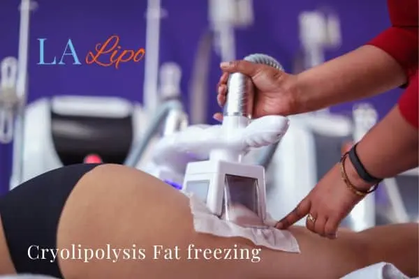 women getting fat freezing Bury St Edmunds