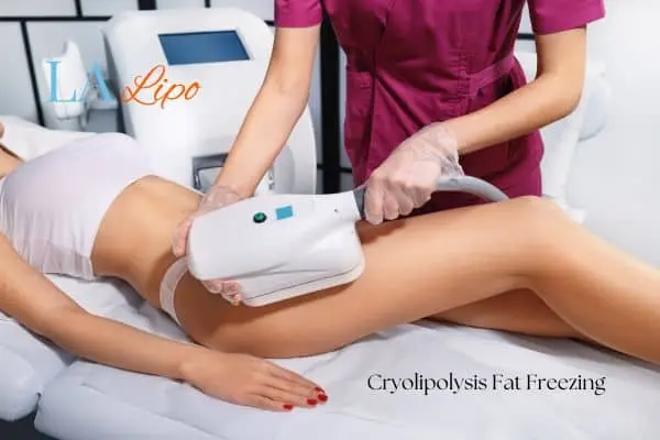 Woman receiving coolsculpting Bury St Edmunds treatment on her thighs