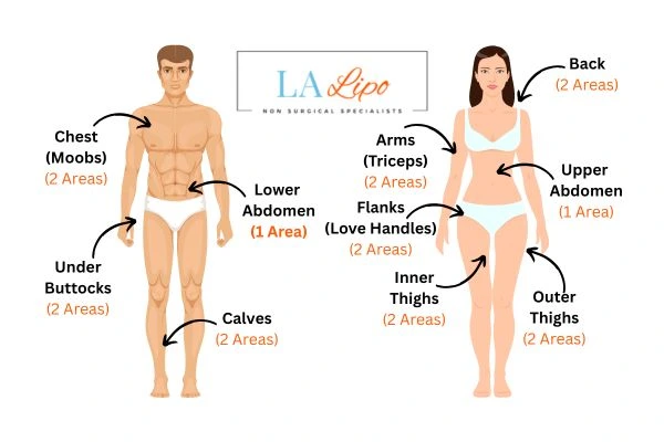 LA LIPO Cryolipolysis Areas Bury St Edmunds