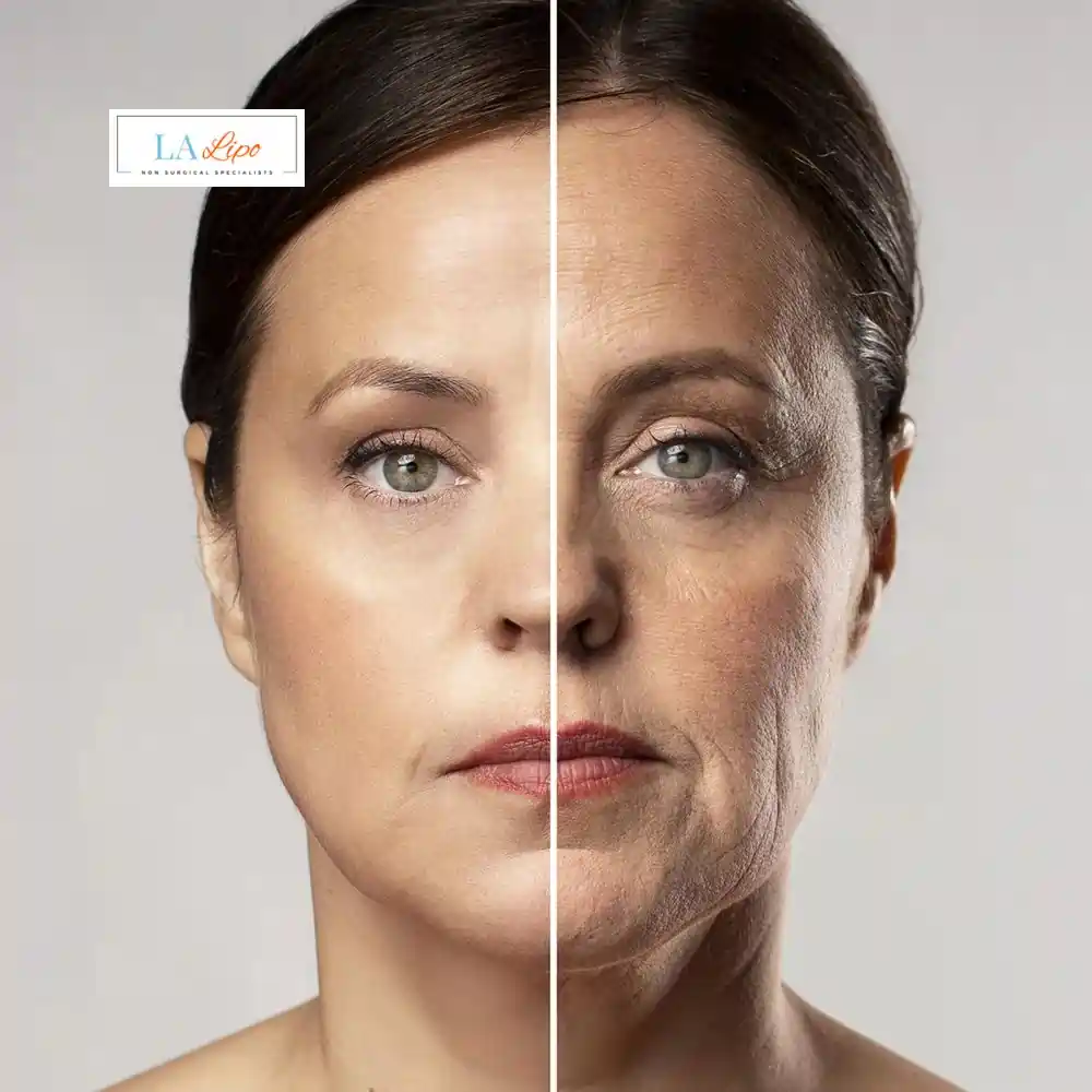 How Can You Tell If Non-Surgical Skin Tightening Is Right for You Bury St Edmunds?