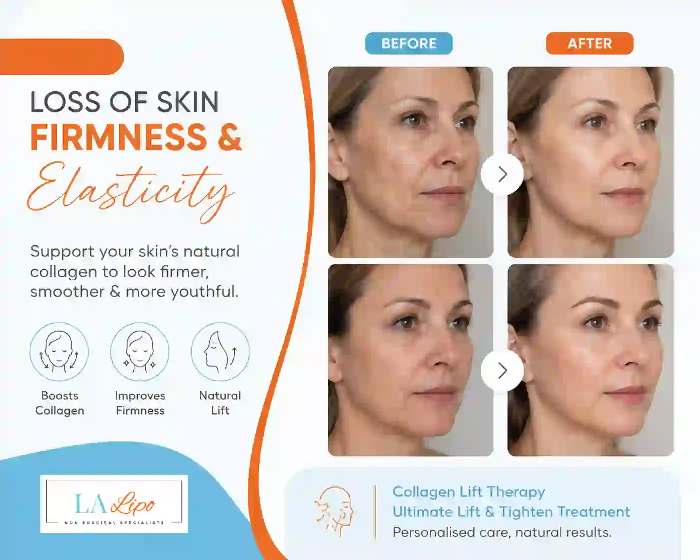 Sign #7: Loss of Skin Firmness and Elasticity Bury St Edmunds